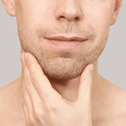 Jaw and chin filler