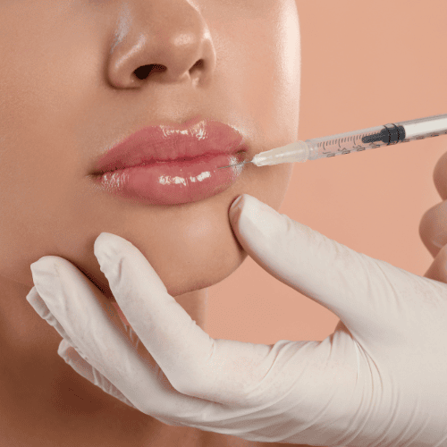 Picture of lip filler