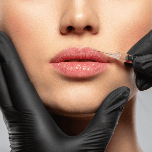Botox for more lip fullness