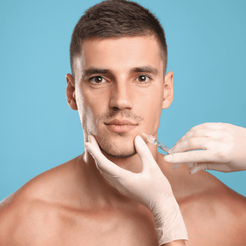 Marionette line filler