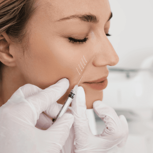 Smile Line Filler